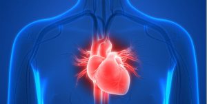 heart transplant