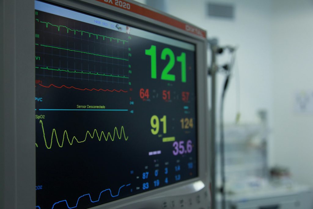 ECG