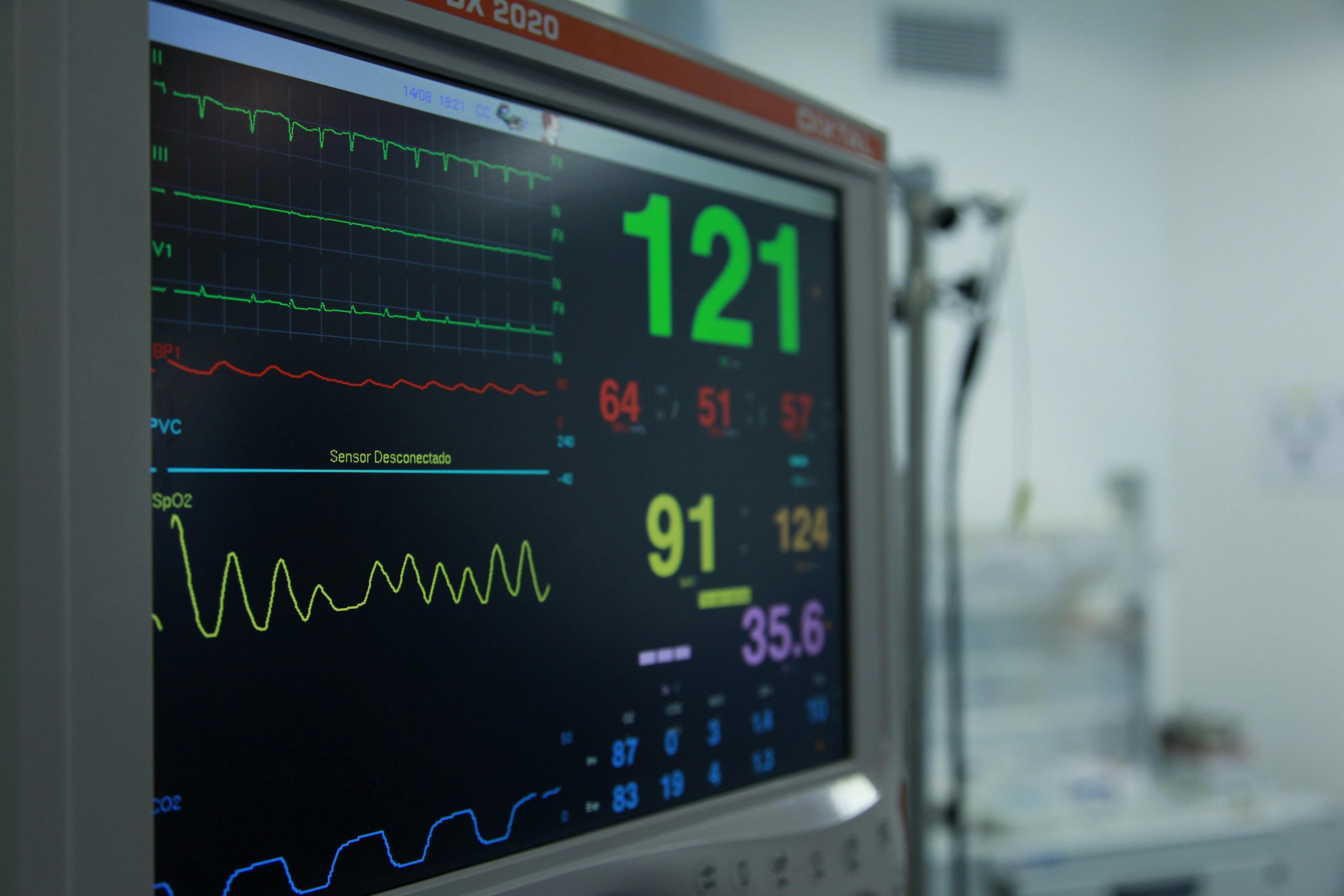 ECG