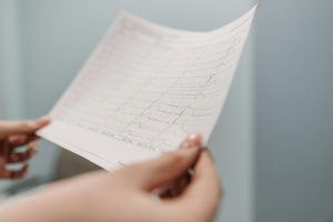 ECG