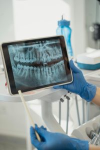 x-ray