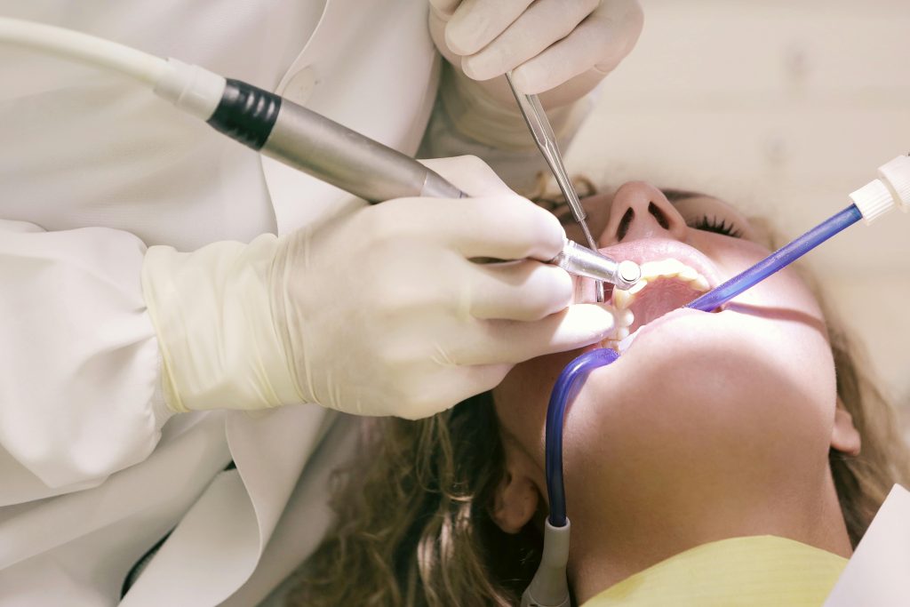 dental implants
