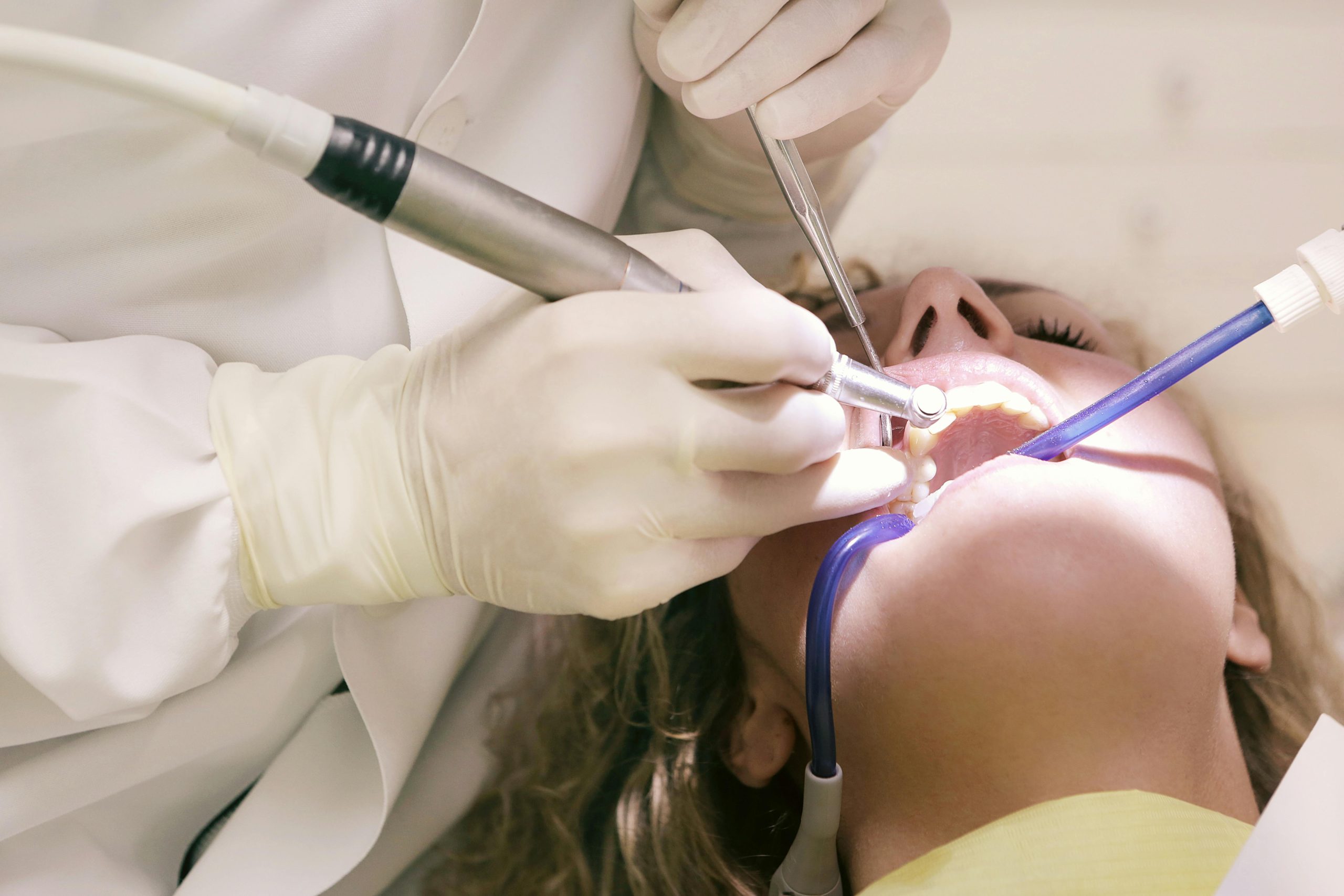 dental implants