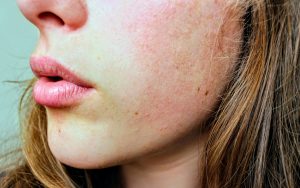 Skincare