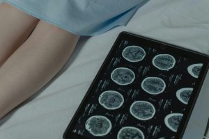 Brain tumor